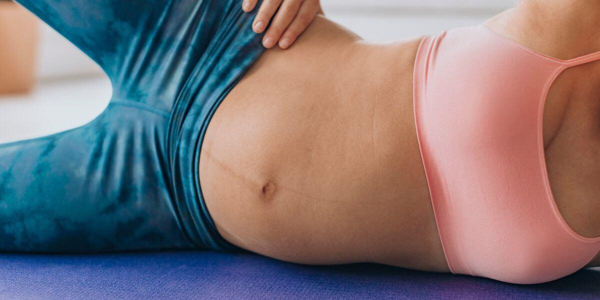 What is Linea Alba? Early Pregnancy Line on Stomach