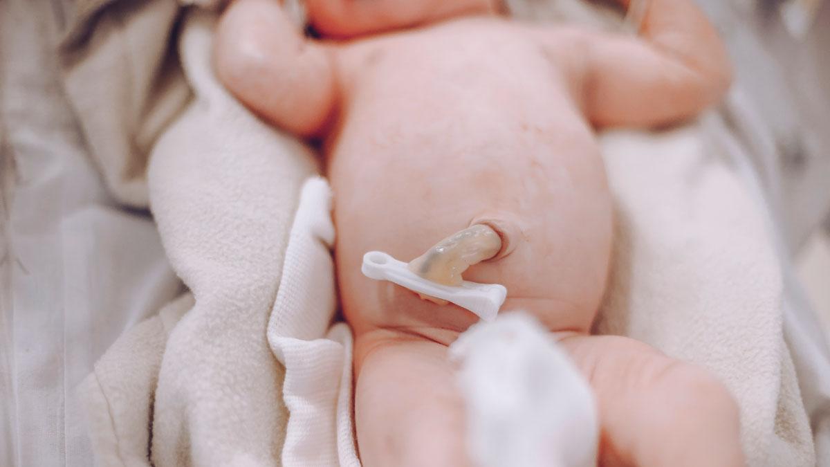 How to care for your baby's umbilical cord stump - Today's Parent