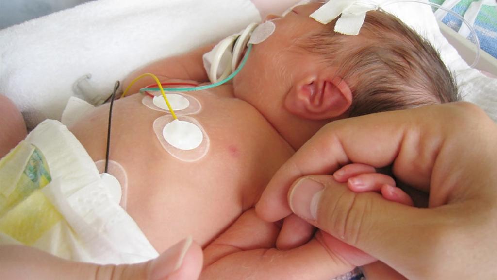 Baby Born at 31 Weeks: Your 31-Week Preemie | Peanut