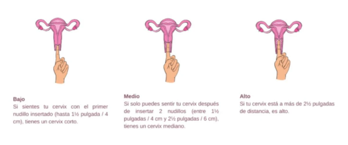 posición de su cuello uterino