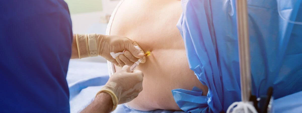 epidural-pregnancy