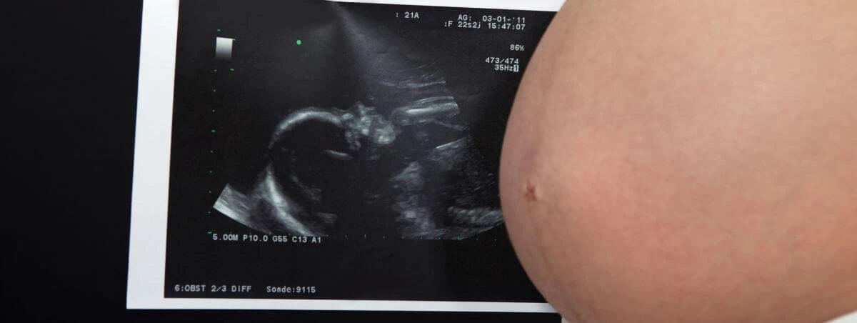 8-month-pregnant-sonogram