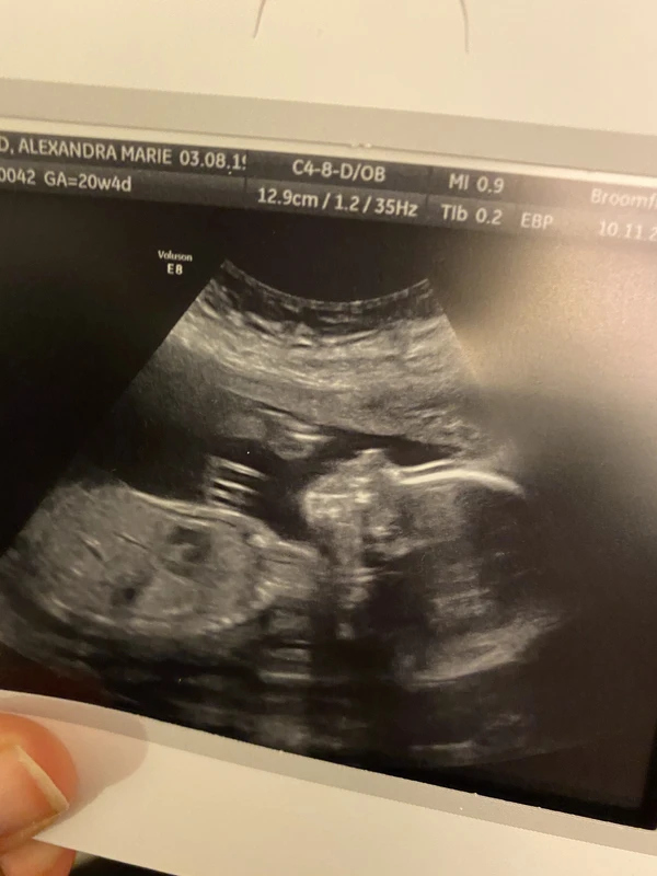 Heart abnormalities and scans