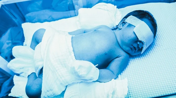 Newborn Jaundice