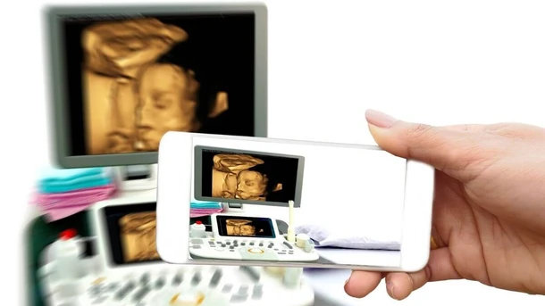 4D ultrasound