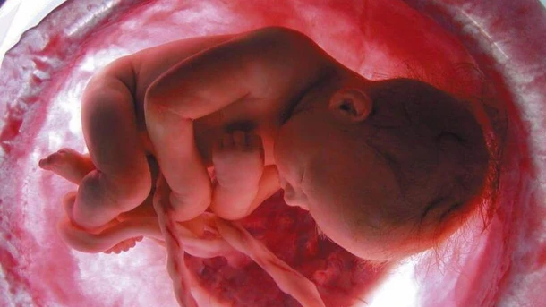 Posterior Placenta