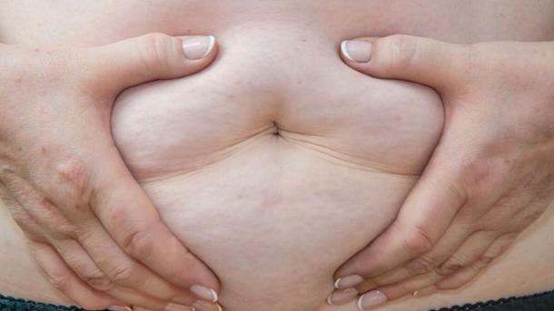 Menopause & Weight Gain