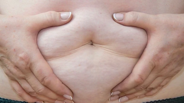 Menopause & Weight Gain