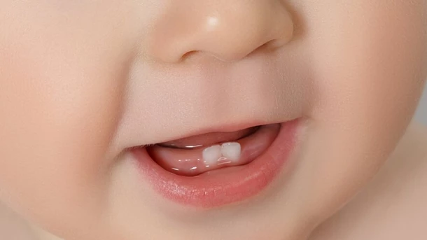 Baby’s Born With Teeth
