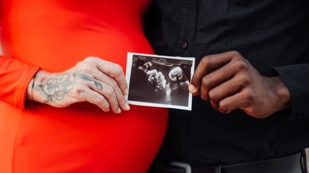 36 Week Ultrasound