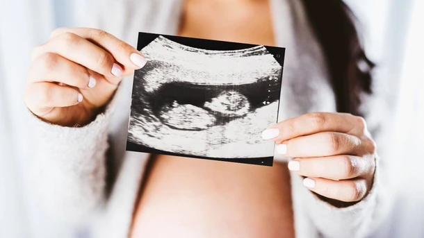 20 Week Ultrasound