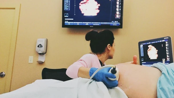 Pregnancy Scans: Your List of Scans During Pregnancy