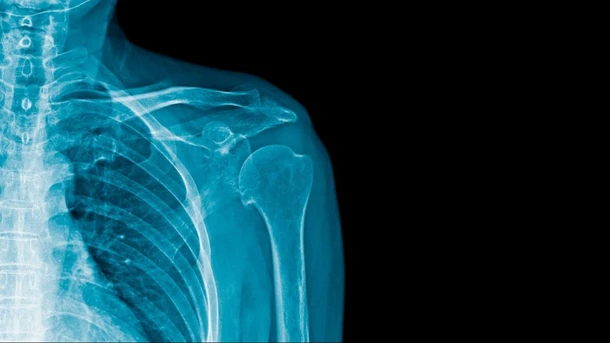 ¿Puedes Hacerte Una Radiografía Durante el Embarazo?