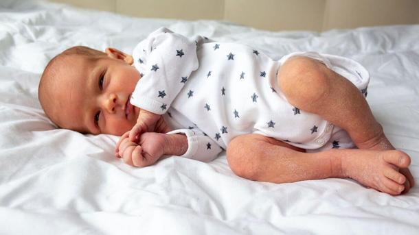 Newborn Dry Skin