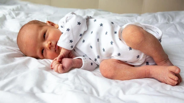 Newborn Dry Skin