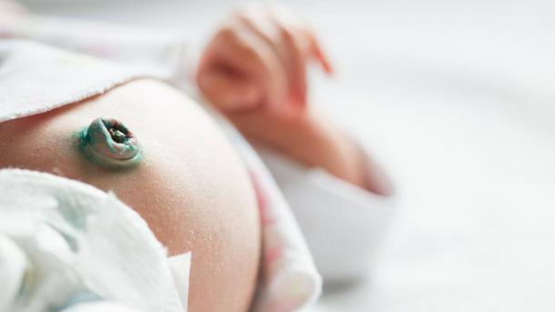 Infected Umbilical Cord