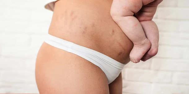What is a Husband Stitch?