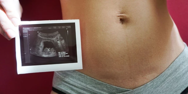 11-week ultrasound