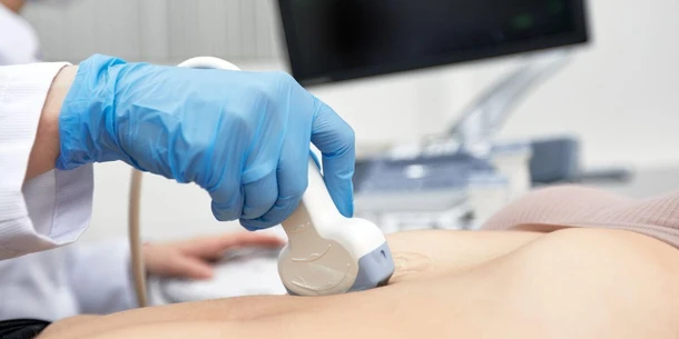 What is a Chorionic Bump in Pregnancy?