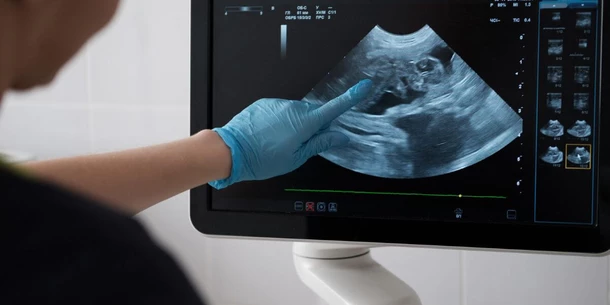 First-trimester ultrasound 