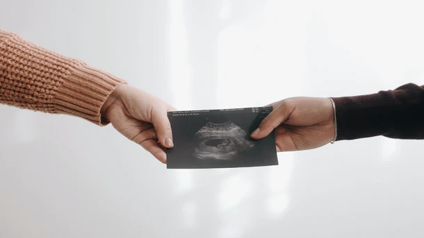8-week ultrasound