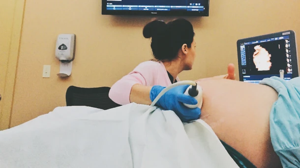 40 week ultrasound
