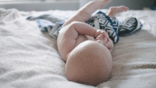 Cradle cap