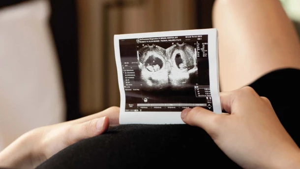 12 week ultrasound