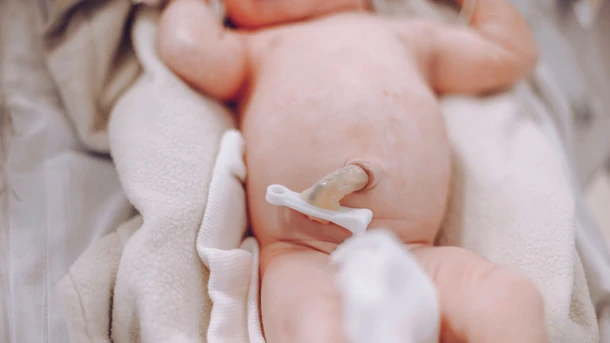 Umbilical cord