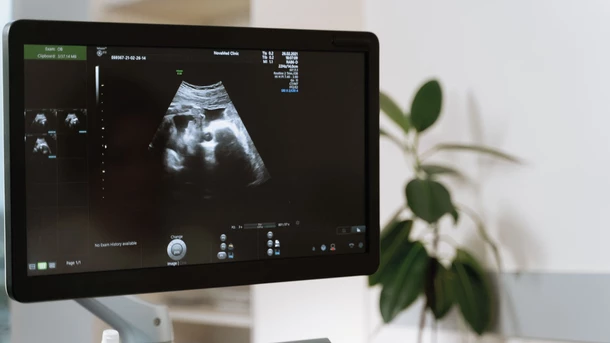First ultrasound during pregnancy