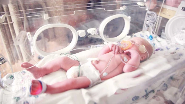 Preemie baby born at 34 weeks