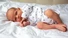 Newborn Dry Skin: What to Know and What to Do