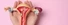 Does Uterus Shape Affect Fertility?