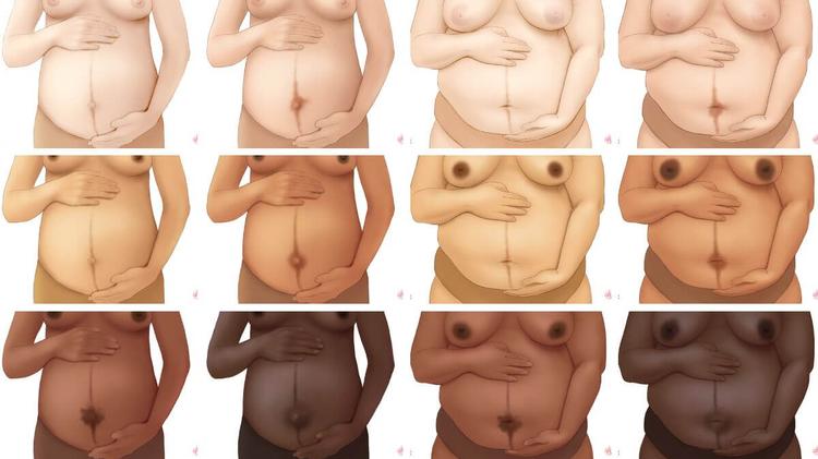 Linea Nigra: Pregnancy Line on Stomach
