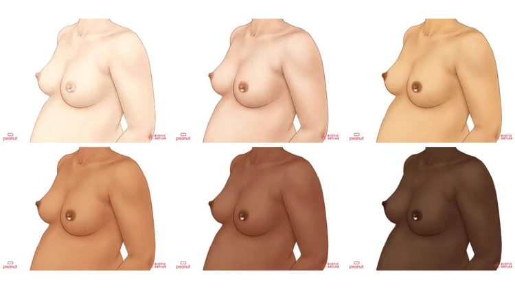 Breasts leaking in pregnancy on different skin tones