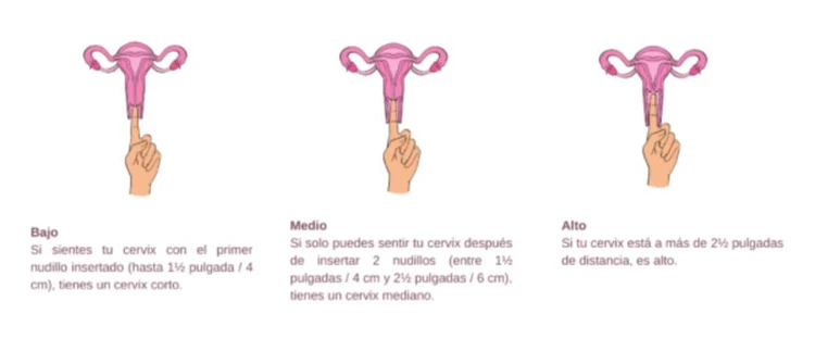 posición de su cuello uterino