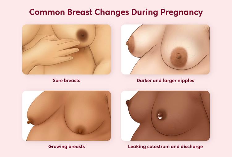 Breast Changes in Early Pregnancy: What to Expect