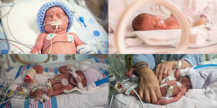 Baby born at 30 weeks pictures