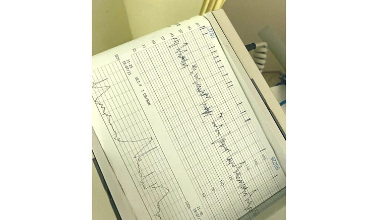 how to read contraction monitor