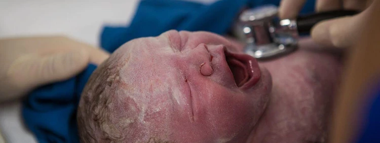 What to Know About Vernix on Your Baby