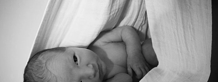 What is a Stork Bite Birthmark on a Baby?