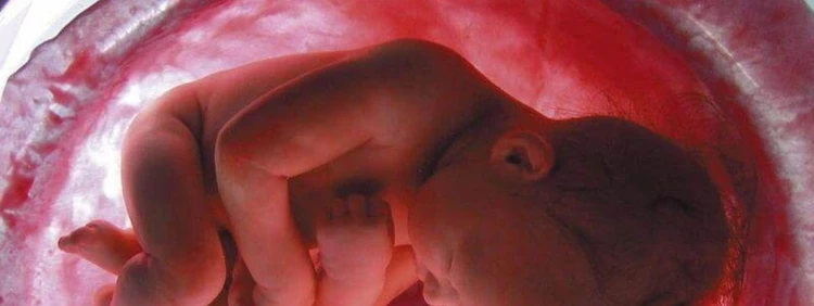 Posterior Placenta: A Brief Guide