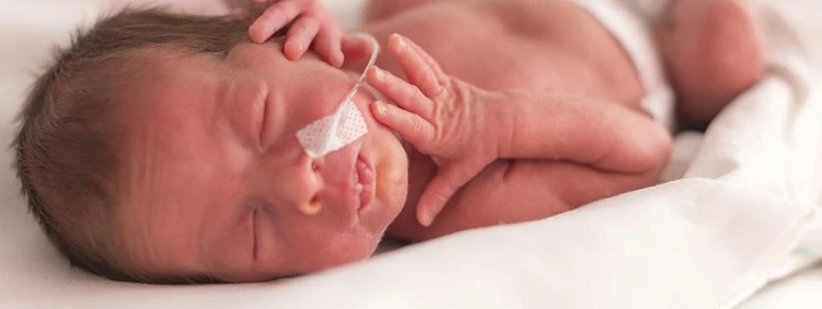 petróleo crudo evitar imitar Bebé Nacido a Las 36 Semanas: Qué Debes Saber | Peanut