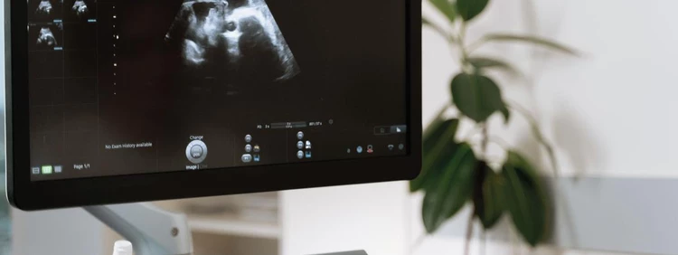 First Trimester Ultrasound: What to Expect