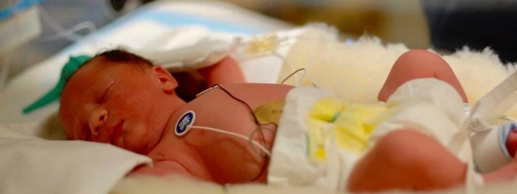 What is NICU?