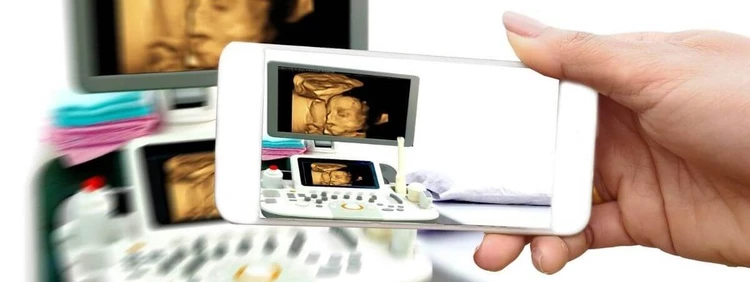 What is a 4D Ultrasound?
