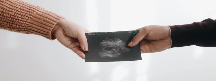 8-Week Ultrasound: What to Expect