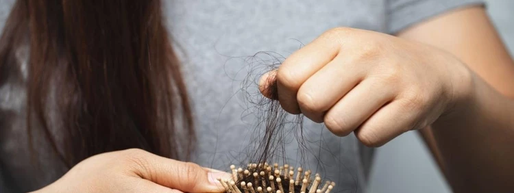 PCOS Hair Loss: Everything You Need to Know