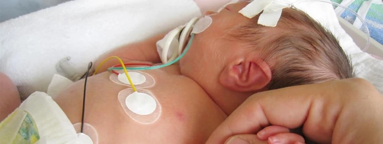 Baby Born at 31 Weeks: Your 31-Week Preemie