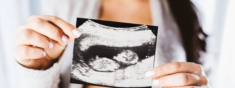 What to Expect at Your 20 Week Ultrasound